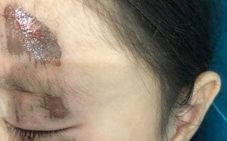 "Буянт ухаа 2" өдөр өнжүүлэхийн хариуцлагагүй байдлаас болж хүүхэд бэртжээ