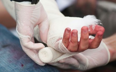 Гэр нь шатсаны улмаас түлэгдсэн хоёр хүүхдийн биеийн байдал сайжирч эхэллээ