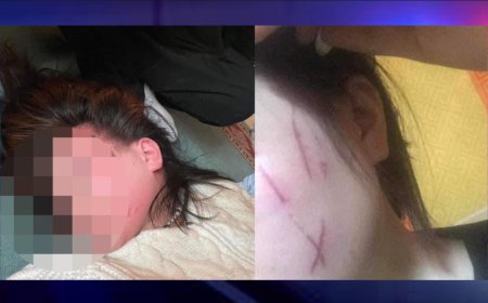 ЦЕГ: Өсвөр насны охид нэгнээ зодсон гэх хэргийг шалгаж байна