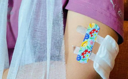 Сурагч охин орцныхоо гадаа нохойд хазуулсан харамсалтай хэрэг гарчээ