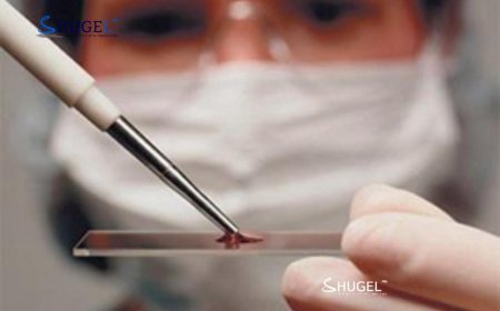 Тэмбүү өвчний 4206 тохиодол бүртгэгджээ