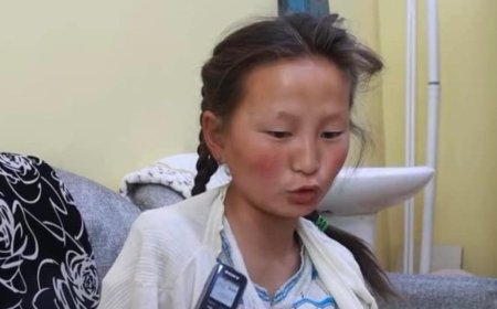 13 настай охин хонины захад чононд бариулсан ч амьд гарч чаджээ