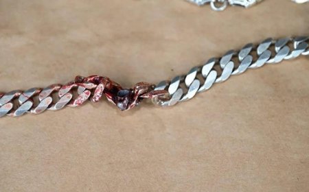 Хүзүүндээ буудуулсан ч түүнийг 10 мм-ийн зузаантай гинж нь амийг нь  аварчээ