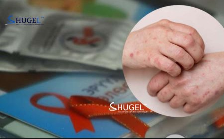 Тэмбүүгийн өвчлөлөөр  Өмнөговь аймаг улсад тэргүүлж байна