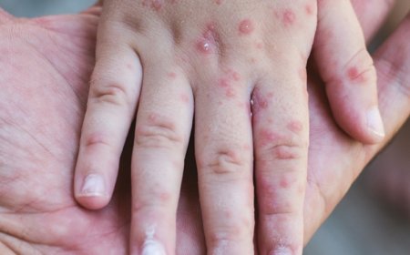 ШУУРХАЙ: 24 цагийн дотор Улаанбурханы 24 тохиолдол батлагджээ